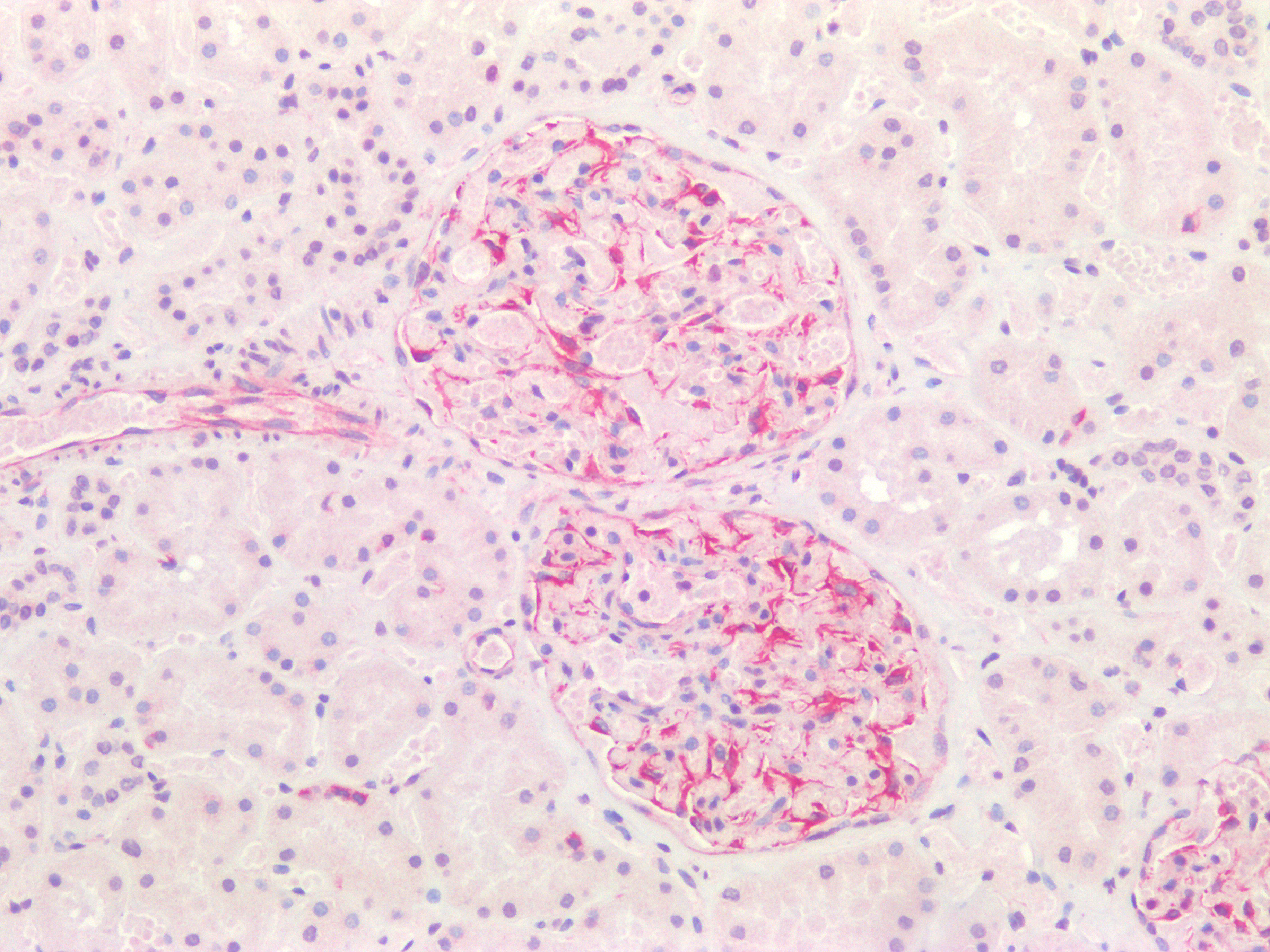 Figure 7. Immunostaining of human paraffin embedded tissue sections of human kidney with MUB1903P (diluted 1:100), showing the specific pattern of vimentin in the mesenchymal cell types, such as fibroblasts in the connective tissue, and podocytes.  As expected, no reactivity is seen in the epithelial cell compartment.